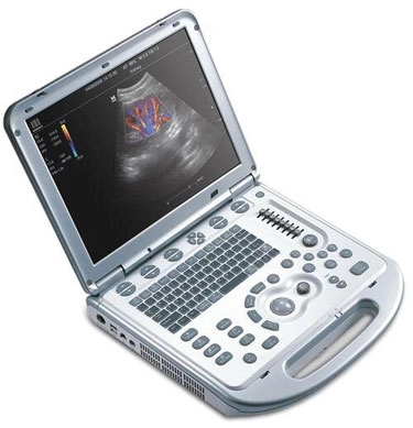 Chiropractic Towson MD Muscuoloskeletal Ultrasound Monitor